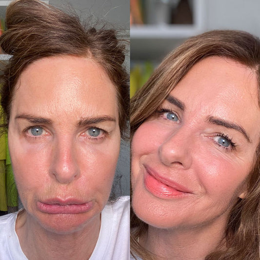 Are you over-cleansing your skin? Tell-tale signs to look out for