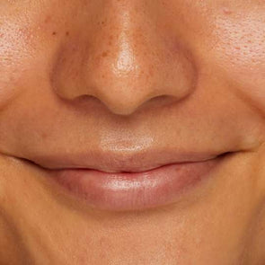 4 easy ways to banish blackheads