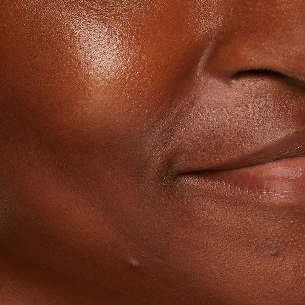 Why is my skin so shiny by lunchtime? Here's what causes oily skin