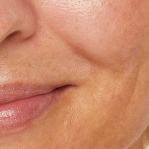Pigmentation – it’s not all the same thing