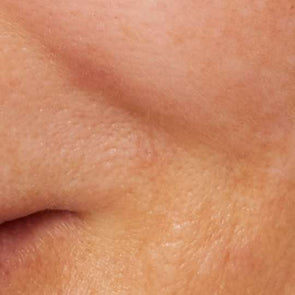Different types of skin pigmentation – and how to tell the difference