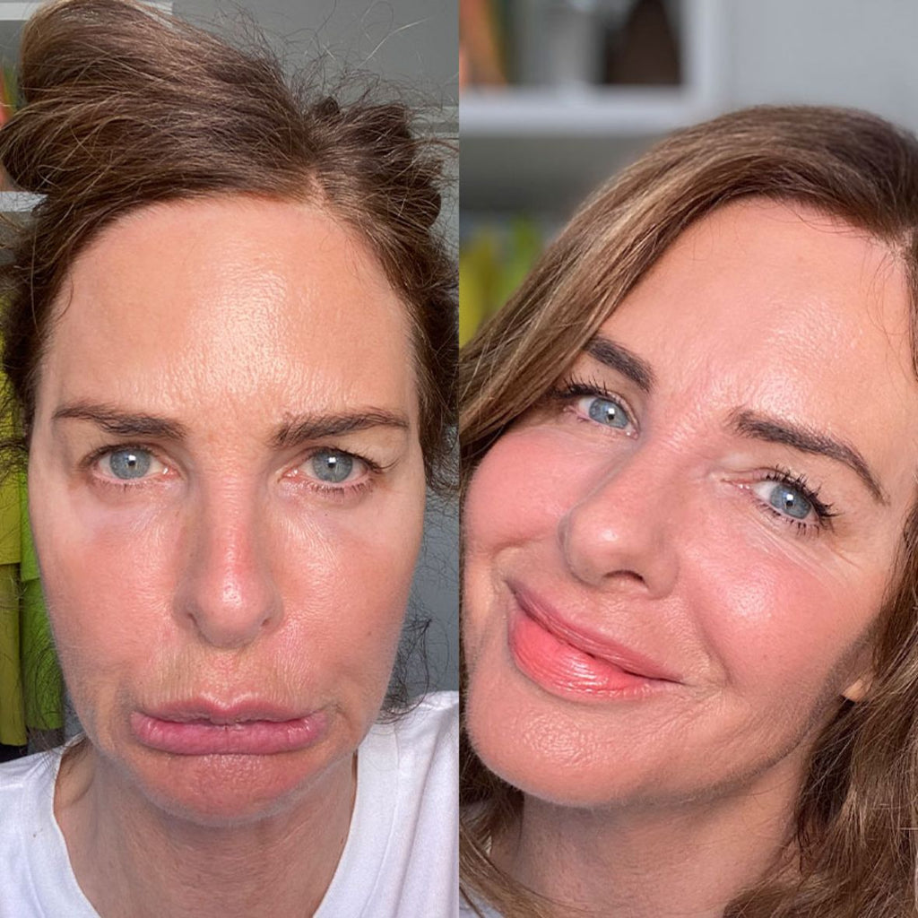 Are you over-cleansing your skin? Tell-tale signs to look out for