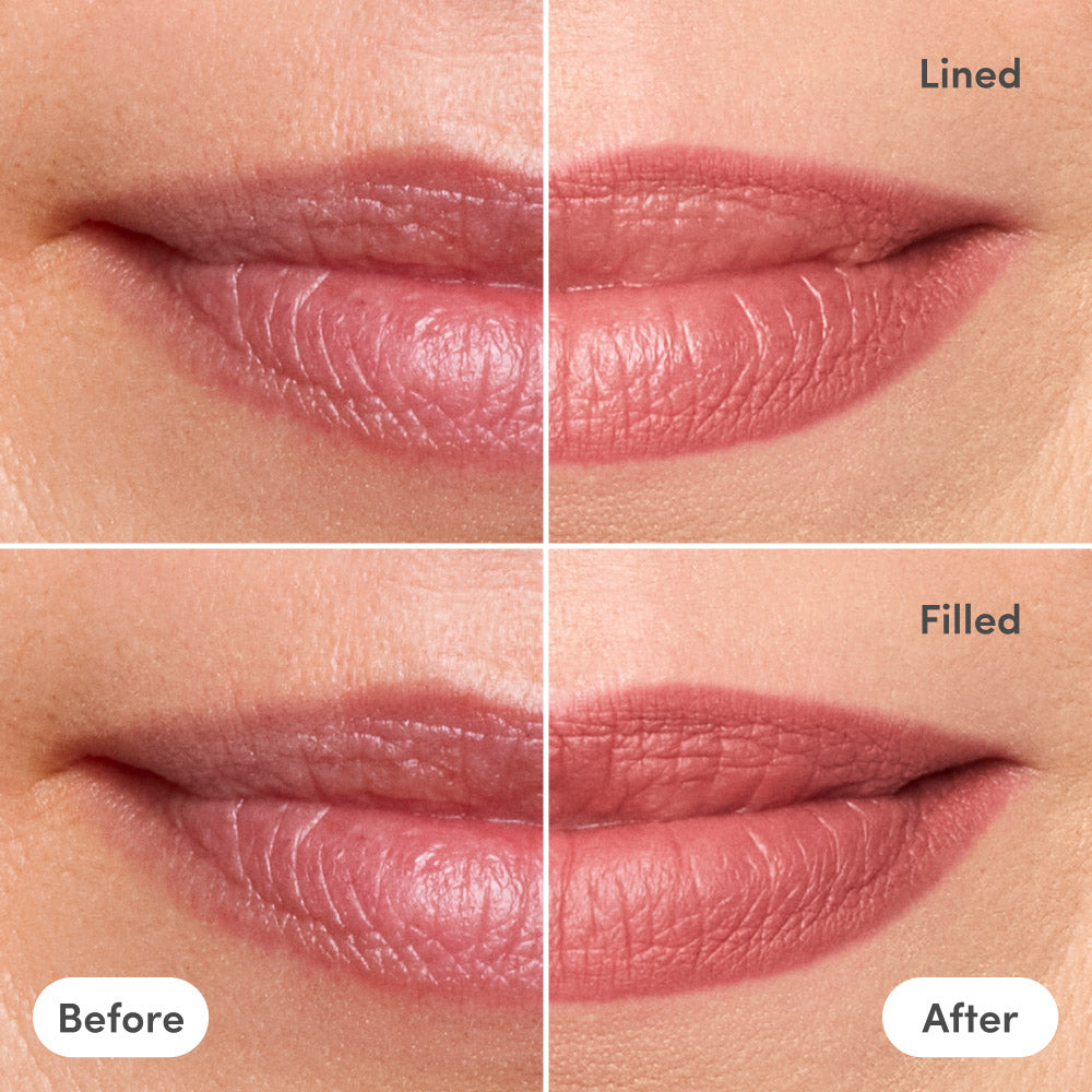 Line2Define Lip