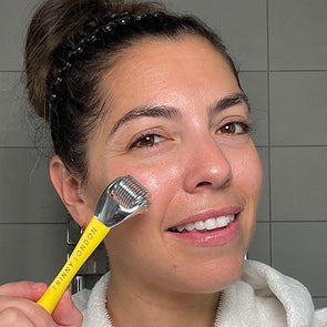  Skincare diaries - Philippa’s microneedle journey