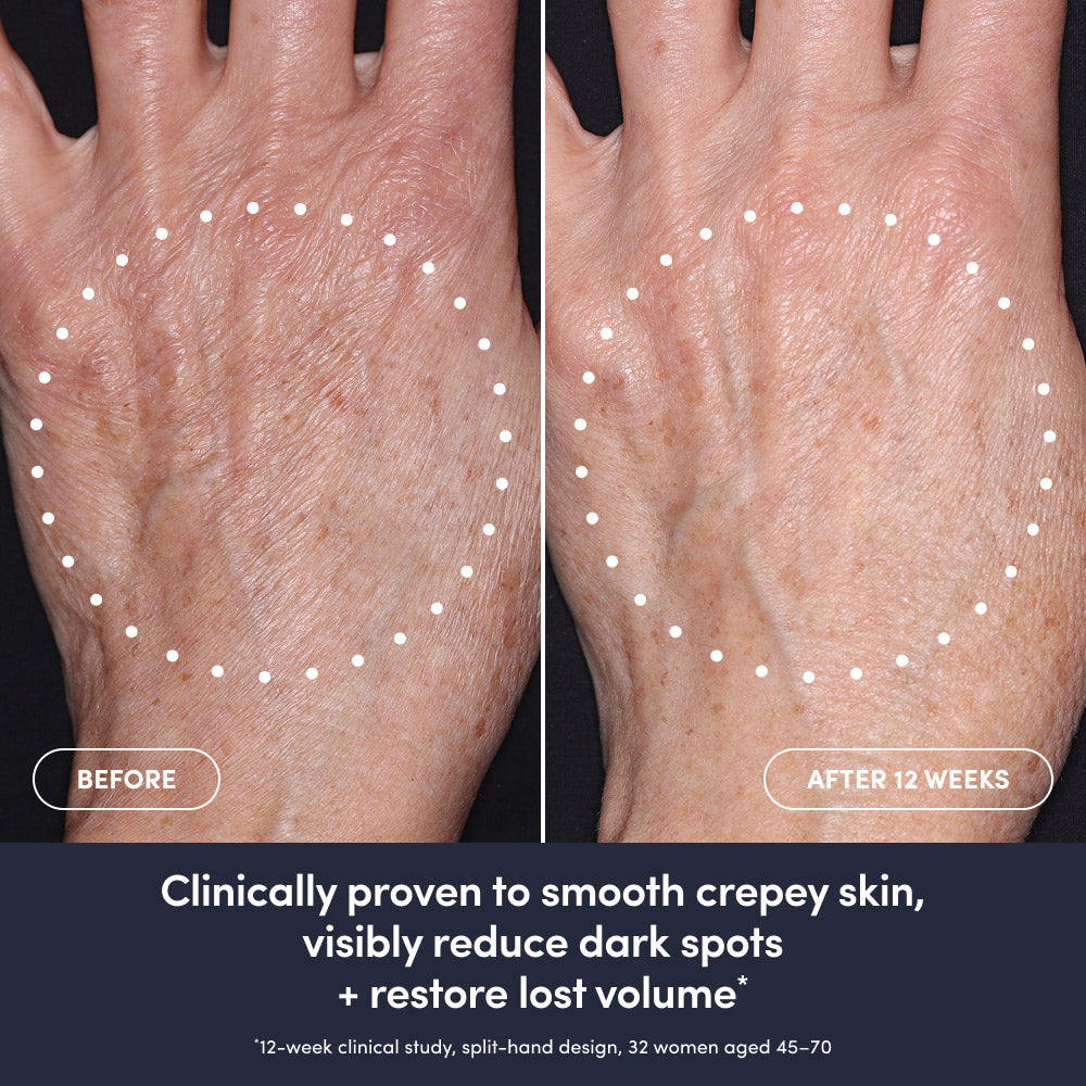 Take Back Time Overnight Hand Transformation