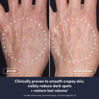 Take Back Time Overnight Hand Transformation