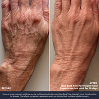 Take Back Time Overnight Hand Transformation