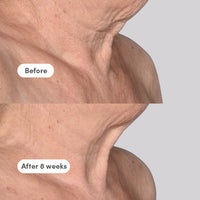 Targeted Treatments