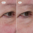 Take Back Time Eye Treatment