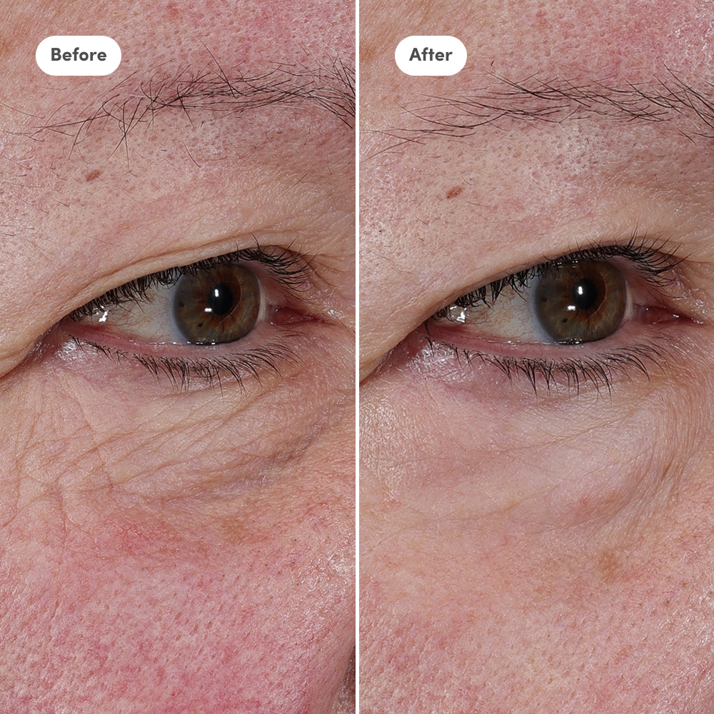 Targeted Treatments