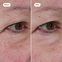 Targeted Treatments