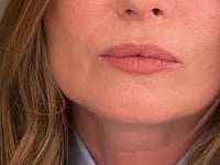 Line2Define Lip